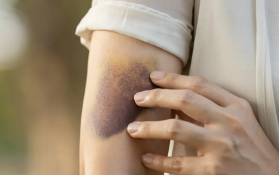 Местный житель избил женщину лопатой в Алматинской области