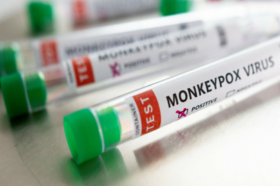 Экспериментальный препарат против оспы обезьян изучают в РК